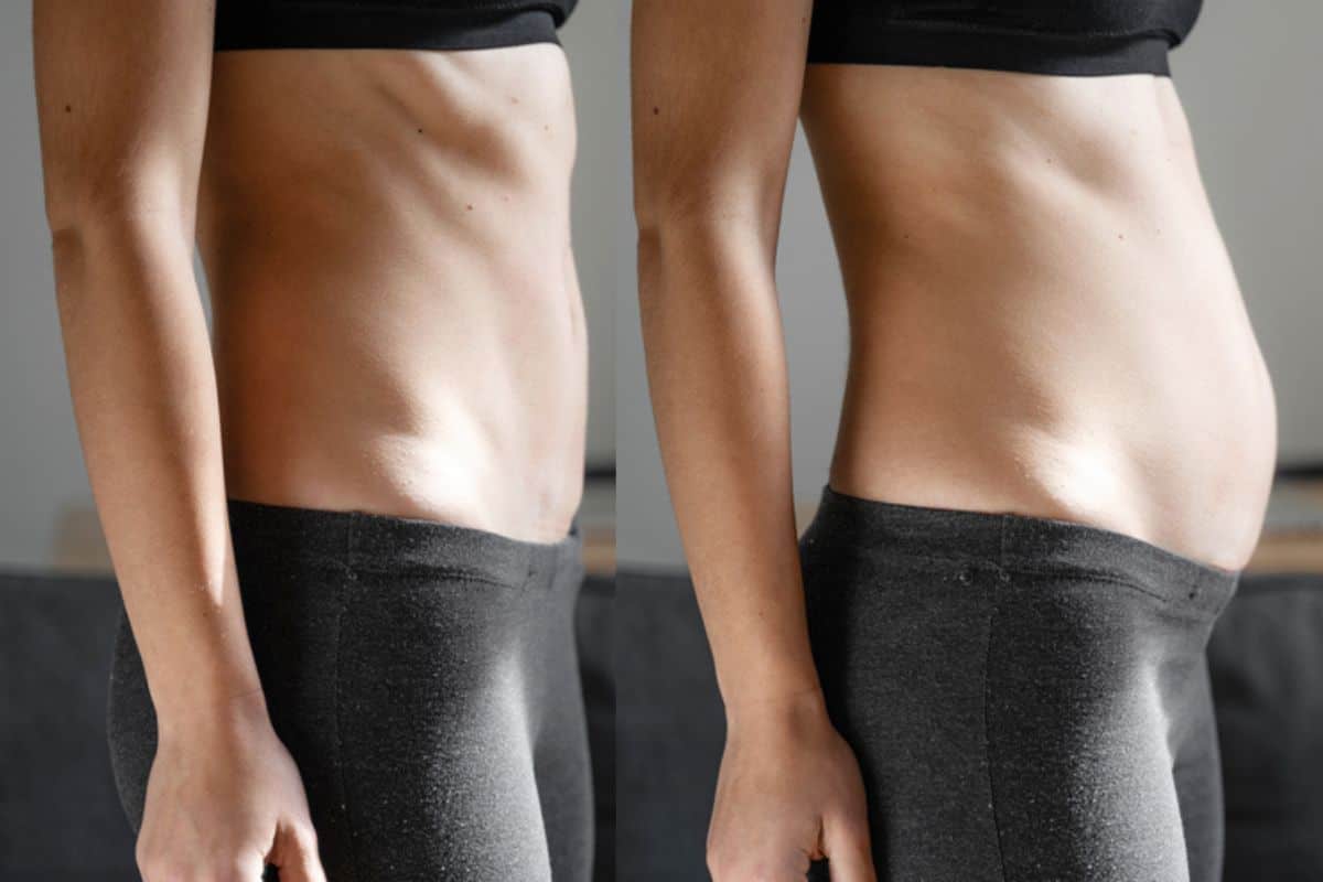 How long does diastasis recti take to improve Batley?