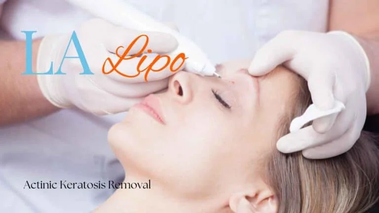 Woman receiving Actinic Keratosis Removal Treatment Batley