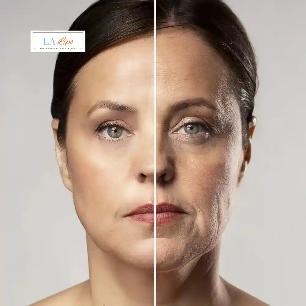 How Can You Tell If Non-Surgical Skin Tightening Is Right for You Batley?