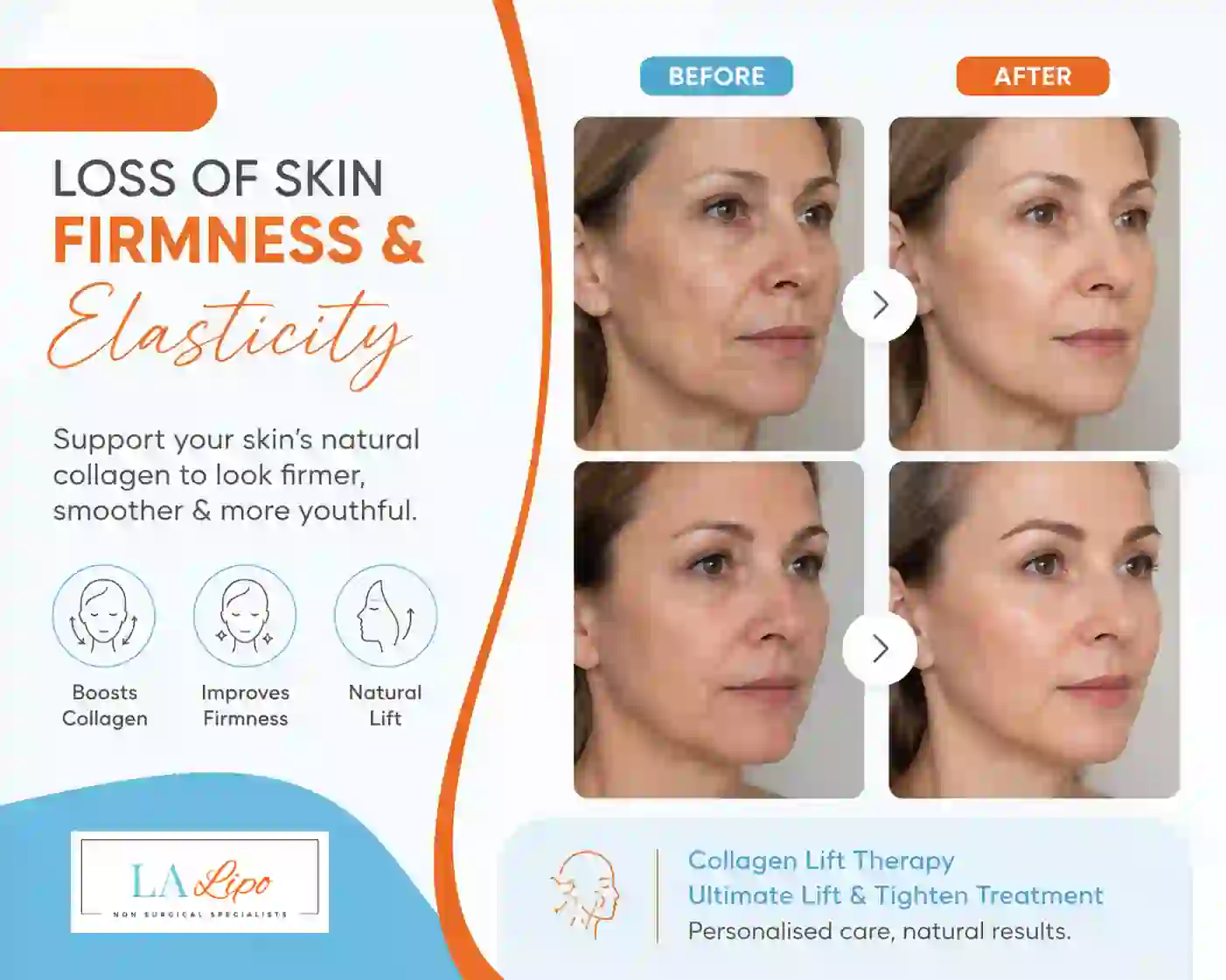 Sign #7: Loss of Skin Firmness and Elasticity Batley